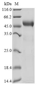 Recombinant Human Disco-interacting protein 2 homolog A (DIP2A), partial