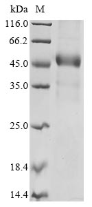 Recombinant Human Disco-interacting protein 2 homolog C (DIP2C), partial