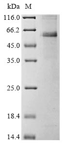 Recombinant Avian infectious bronchitis virus Nucleoprotein (N)