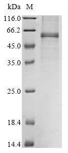Recombinant Avian infectious bronchitis virus Nucleoprotein (N)