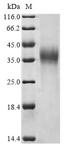 Recombinant Avian infectious bronchitis virus Spike glycoprotein (S), partial
