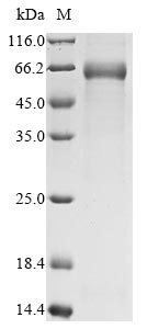 Recombinant Avian infectious bronchitis virus Nucleoprotein (N)