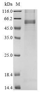 Recombinant Avian infectious bronchitis virus Nucleoprotein (N)