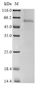 Recombinant Avian infectious bronchitis virus Nucleoprotein (N)