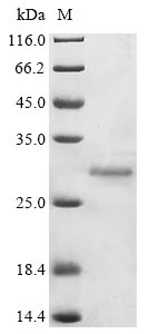Recombinant Avian infectious bronchitis virus Replicase polyprotein 1ab (rep), partial
