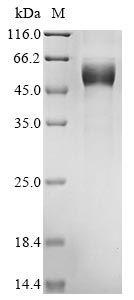 Recombinant Mouse Heme-binding protein 1 (Hebp1)