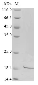Recombinant Human Disco-interacting protein 2 homolog A (DIP2A), partial