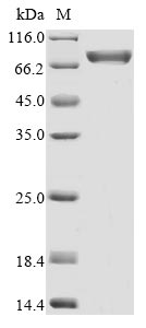 Recombinant Human Mannan-binding lectin serine protease 2 (MASP2)