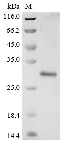 Recombinant Avian infectious bronchitis virus Replicase polyprotein 1ab (rep), partial