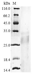 Recombinant Human Ribonuclease T2 (RNASET2)