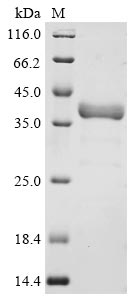 Recombinant Human Fructose-bisphosphate aldolase C (ALDOC)