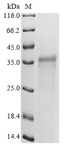 Recombinant Mouse Leukocyte cell-derived chemotaxin-2 (Lect2)