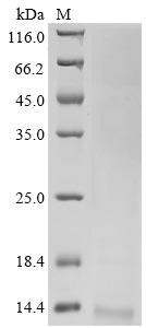 Recombinant Avian infectious bronchitis virus Non-structural protein 3b (3b)