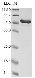 Recombinant Cricetulus griseus Calreticulin (CALR)