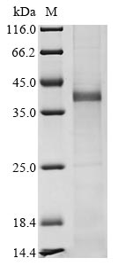 Recombinant Human Zinc finger protein ZIC 2 (ZIC2), partial