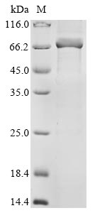 Recombinant Human parainfluenza 4b virus Nucleoprotein (N)
