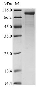 Recombinant Human Complement C1s subcomponent (C1S)