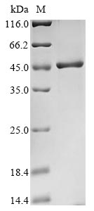 Recombinant Human Poly (rC)-binding protein 2 (PCBP2)