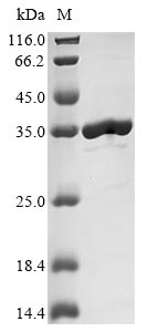 Recombinant Escherichia coli Uncharacterized protein YncE (yncE)