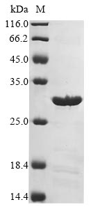 Recombinant Mycobacterium tuberculosis Cell division protein FtsQ (ftsQ), partial