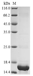 Recombinant Human Protein DEK (DEK) (S375SLEH), partial