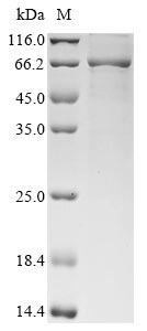 Recombinant Yersinia pestis Putative accessory processing protein (hmwC), partial