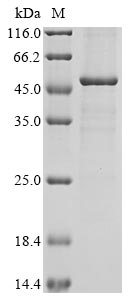 Recombinant Human Prolactin regulatory element-binding protein (PREB), partial