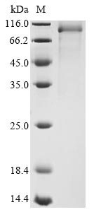 Recombinant Mouse kidney parvovirus Nonstructural protein NS1 (rep)