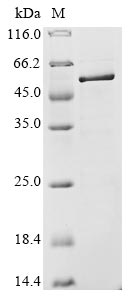 Recombinant Avian infectious bronchitis virus Nucleoprotein (N)