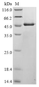 Recombinant Avian infectious bronchitis virus Nucleoprotein (N)