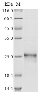 Recombinant Human Phospholipid hydroperoxide glutathione peroxidase(GPX4),partial