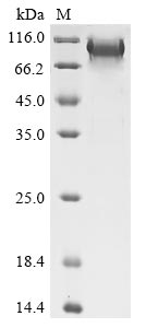 Recombinant Human B-cell lymphoma 6 protein (BCL6)