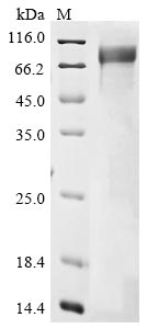 Recombinant Human Choline O-acetyltransferase (CHAT), partial