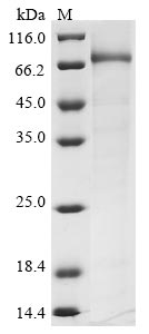 Recombinant Human Choline O-acetyltransferase (CHAT), partial