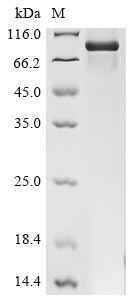 Recombinant Human Pescadillo homolog (PES1)