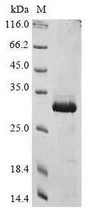 Recombinant Human COMM domain-containing protein 5 (COMMD5)