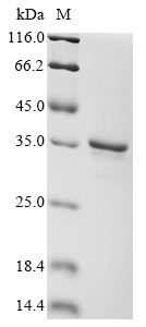 Recombinant Human Retinoic acid-induced protein 3 (GPRC5A), partial