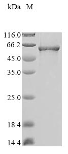Recombinant Mycoplasma genitalium Uncharacterized protein MG281 (MG281)