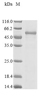 Recombinant Measles virus Fusion glycoprotein F0 (F)