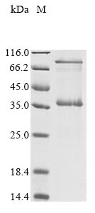 Recombinant Mycoplasma pneumoniae P30 adhesin (p30)