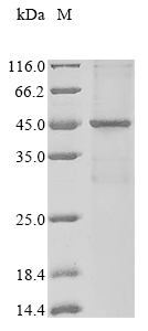 Recombinant Human Phosphatidylcholine:ceramide cholinephosphotransferase 1 (SGMS1)