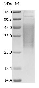 Recombinant Human Gap junction alpha-1 protein (GJA1), partial