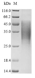 Recombinant Mouse Gap junction alpha-1 protein (Gja1), partial