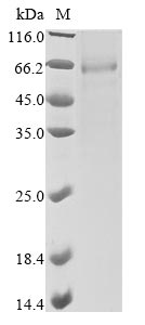 Recombinant Human Prolactin receptor (PRLR), partial