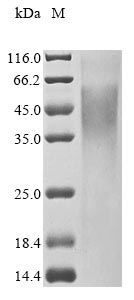 Recombinant Mouse Tripeptidyl-peptidase 2 (Tpp2), partial