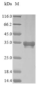 Recombinant Mouse Myocilin (Myoc), partial