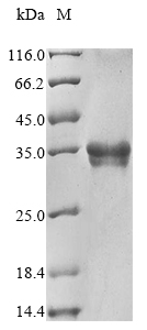 Recombinant Rat Endothelin-1 (Edn1), partial