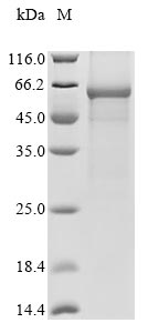 Recombinant Citrus unshiu Limonoid UDP-glucosyltransferase