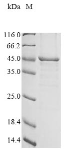 Recombinant Rat Lysosomal acid lipase/cholesteryl ester hydrolase (Lipa)