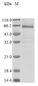 Recombinant Human E3 ubiquitin-protein ligase RNF8(RNF8)